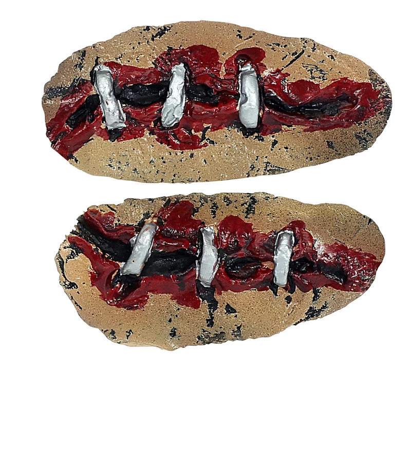Open wond klein met nietjes